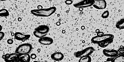 Aufnahme einer polydispersen Blasenströmung ©Copyright: Hessenkemper, Henrik