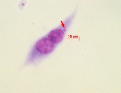 Mausfibroblast