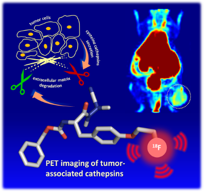 3D model of a radiotracer that is capable of binding to enzymes that contribute to the metastatic spread of tumors.