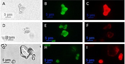 Die mikroskopischen Bilder zeigen die Wechselwirkung von Phagenpartikeln mit Mineralien. Abb. A-C stellt LaPO4:Ce,Tb (LAP) spezifische Phagen dar, die mit hoher Affinität zu LAP-Partikeln binden. Abb. D-D zeigen Wildtyp-Phagen ohne LAP-Affinität und Abb. G-I zeigen eine Mischung aus SiO2 und LAP nach Kontakt mit LAP spezifischen Phagenpartikeln. Grün: Fluoreszenz von LAP (FITC Filter); rot: phagenspezifische Antikörper mit Alexa 594 markiert (TRITC Filter)