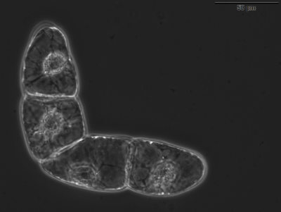 Lichtmikroskopische Aufnahme der BY-2-Zellen. ©Copyright: Klotzsche, Max