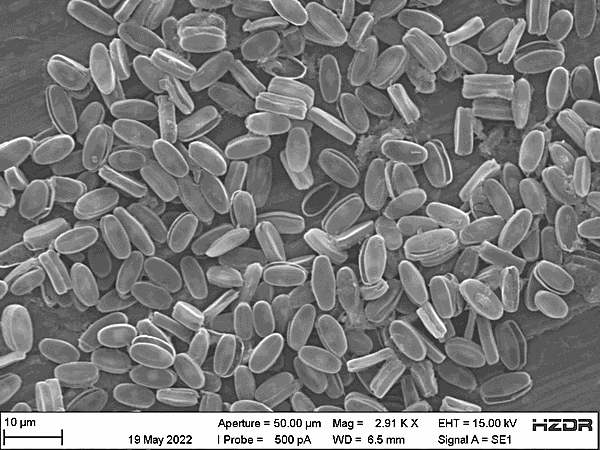 Foto: SEM-Bild der untersuchten Kieselalgen bei Anwesenheit von Bakterien (in Symbiose) ©Copyright: Yihua He