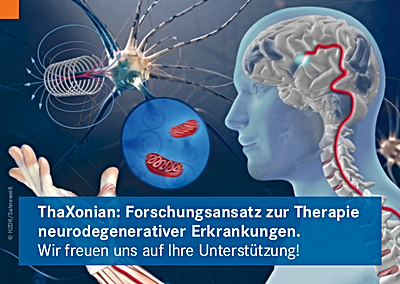 Foto: ThaXonian: Forschungsansatz zur Therapie neurodegenerativer Erkrankungen. Cover Info-Postkarte ©Copyright: HZDR