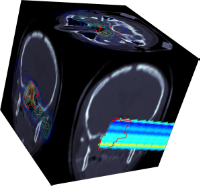 Particle therapy - PET - Comparison of measurement and simulation